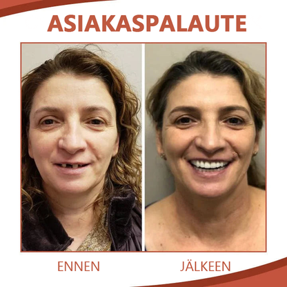 Uusi hammasproteesin silikonivuorauspaketti (rajoitettu aika 50% alennus)
